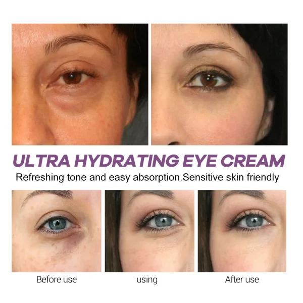 Retinol Remove Wrinkle Eyes Cream Instant Firming Lifting Fade Fine Lines Eye Bags Anti Dark Circle Brightening Beauty Skin Care - Image 3